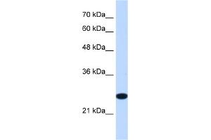 WB Suggested Anti-TMEM109 Antibody Titration:  1. (TMEM109 Antikörper  (Middle Region))