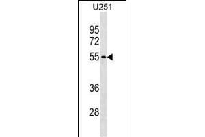 KLHDC7B Antibody (C-term) (ABIN1537171 and ABIN2838249) western blot analysis in  cell line lysates (35 μg/lane). (KLHDC7B Antikörper  (C-Term))