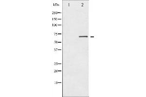 Western blot analysis of PKR expression in Starvation treated K562 whole cell lysates,The lane on the left is treated with the antigen-specific peptide. (EIF2AK2 Antikörper  (Internal Region))