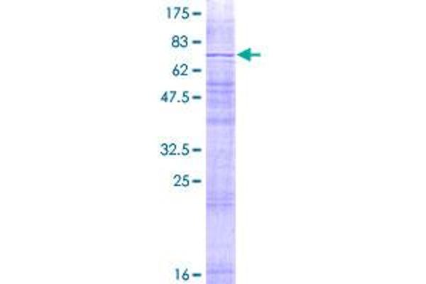 MMD2 Protein (AA 1-246) (GST tag)