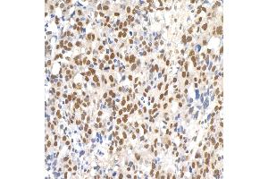 Immunohistochemistry (IHC) image for anti-Paf1, RNA Polymerase II Associated Factor, Homolog (PAF1) (AA 475-525) antibody (ABIN7454365)