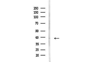 anti-Alcohol Dehydrogenase 6 (Class V) (ADH6) antibody