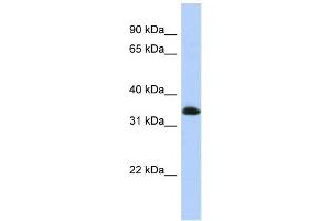 Western Blotting (WB) image for anti-Zinc Finger Protein 511 (ZNF511) antibody (ABIN2458281) (ZNF511 Antikörper)