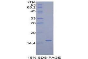 SDS-PAGE analysis of Human Golgi Glycoprotein 1 Protein.