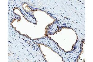 IHC analysis of BI-1/TMBIM6 using anti-BI-1/TMBIM6 antibody (ABIN7603199). (Bax Inhibitor 1 Antikörper  (N-Term))