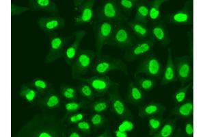 Immunofluorescence analysis of A549 cells using RFC1 antibody. (RFC1 Antikörper)