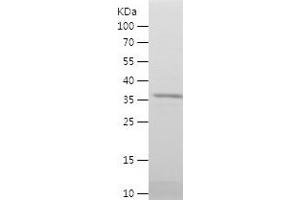 Western Blotting (WB) image for serine Hydroxymethyltransferase 2 (Mitochondrial) (SHMT2) (AA 24-147) protein (His-IF2DI Tag) (ABIN7125035) (SHMT2 Protein (AA 24-147) (His-IF2DI Tag))