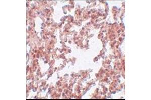 Immunohistochemistry of SRPX2 in rat lung tissue with this product at 5 μg/ml. (SRPX2 Antikörper  (N-Term))