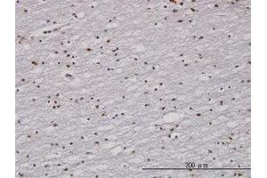 Image no. 1 for anti-Cell Cycle Checkpoint Protein RAD1 (RAD1) (AA 1-90) antibody (ABIN598565) (RAD1 Antikörper  (AA 1-90))