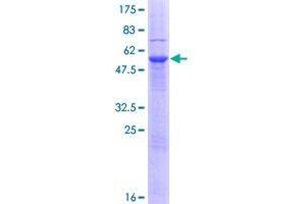 Endonuclease V Protein (ENDOV) (AA 1-264) (GST tag)