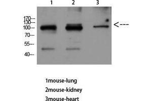 Western Blot (WB) analysis of Mouse Lung Mouse Kidney Mouse Heart using VE-Cadherin Polyclonal Antibody diluted at 1:500. (Cadherin 5 Antikörper  (Internal Region))