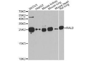 Western blot analysis of extracts of various cell lines, using RALB antibody. (RALB Antikörper  (AA 1-206))