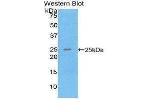Detection of Recombinant SPRY3, Human using Polyclonal Antibody to Sprouty Homolog 3 (SPRY3) (SPRY3 Antikörper  (AA 91-288))