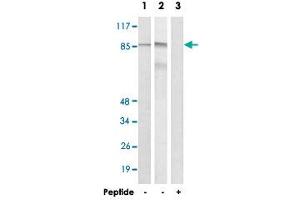 Western blot analysis of extracts from LoVo cells (Lane 1 and lane 3) and RAW 264.