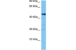 Host:  Mouse  Target Name:  CTBP1  Sample Tissue:  Mouse Brain  Antibody Dilution:  1ug/ml (CTBP1 Antikörper  (C-Term))