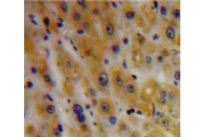Used in DAB staining on fromalin fixed paraffin-embedded Liver tissue (TGFBI Antikörper  (AA 423-632))