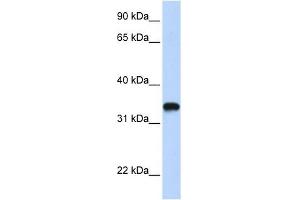 HAS3 antibody used at 1 ug/ml to detect target protein. (HAS3 Antikörper  (C-Term))