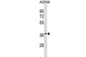Western Blotting (WB) image for anti-Olfactory Receptor, Family 52, Subfamily J, Member 3 (OR52J3) antibody (ABIN3001032) (OR52J3 Antikörper)