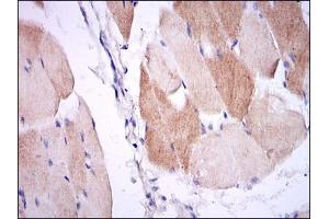 Immunohistochemical analysis of paraffin-embedded muscle tissues using IL1B mouse mAb with DAB staining. (IL-1 beta Antikörper)