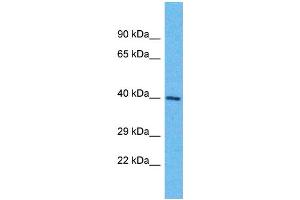 Western Blotting (WB) image for anti-Olfactory Receptor, Family 6, Subfamily K, Member 6 (OR6K6) (C-Term) antibody (ABIN2791765) (OR6K6 Antikörper  (C-Term))