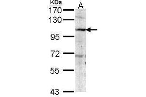 WB Image Sample (30 ug of whole cell lysate) A: A431 , 7. (AOC3 Antikörper)