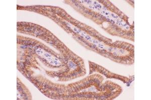 IHC-P: alpha Catenin antibody testing of mouse intestine tissue