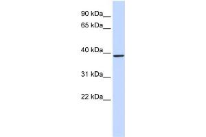 WB Suggested Anti-QPCT Antibody Titration:  0. (QPCT Antikörper  (Middle Region))
