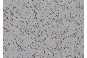 ABIN6277264 at 1/100 staining Human gastric tissue by IHC-P. (MMP14 Antikörper  (C-Term))