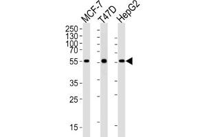 Western Blotting (WB) image for anti-Aldehyde Dehydrogenase 6 Family, Member A1 (ALDH6A1) antibody (ABIN2995317) (ALDH6A1 Antikörper)