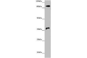Western blot All lanes: DNMT3B antibody at 14 μg/mL + Hela whole cell lysate Secondary Goat polyclonal to rabbit IgG at 1/10000 dilution Predicted band size: 96, 94, 87, 81, 89, 95, 78, 82 kDa Observed band size: 96, 37 kDa (DNMT3B Antikörper  (AA 1-100))