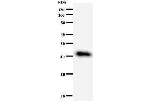 Western Blotting (WB) image for anti-DEAD (Asp-Glu-Ala-Asp) Box Polypeptide 27 (DDX27) antibody (ABIN933004) (DDX27 Antikörper)