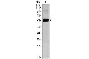 Western Blot showing PAX6 antibody used against human PAX6 (AA: 1-223) recombinant protein.