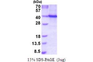 SDS-PAGE (SDS) image for Spleen Focus Forming Virus (SFFV) Proviral Integration Oncogene Spi1 (SPI1) (AA 1-271) protein (His tag) (ABIN5854082)