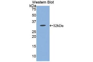 Western blot analysis of the recombinant protein. (CD38 Antikörper  (AA 54-301))