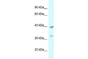 Western Blot showing STOML2 antibody used at a concentration of 1 ug/ml against 721_B Cell Lysate