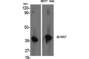 Western Blot (WB) analysis of specific cells using 3beta-HSD7 Polyclonal Antibody. (3beta-HSD7 (Internal Region) Antikörper)