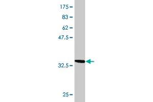 Western Blot detection against Immunogen (36. (TOM1 Antikörper  (AA 394-491))