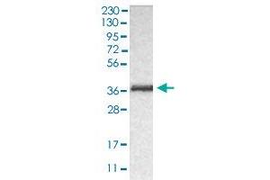 Western blot analysis of human RT-4 cell line with CRKL polyclonal antibody . (CrkL Antikörper  (AA 125-301))