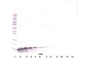 Image no. 3 for anti-gamma-Interferon-Induced Monokine (CXCL9) antibody (ABIN465139) (CXCL9 Antikörper)