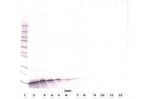 Image no. 3 for anti-gamma-Interferon-Induced Monokine (CXCL9) antibody (ABIN465139)