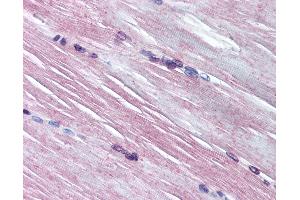 Anti-AMPD1 antibody IHC of human skeletal muscle. (AMPD1 Antikörper  (AA 140-190))