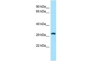 Host: Rabbit Target Name: PIH1D1 Sample Type: A549 Whole Cell lysates Antibody Dilution: 1.