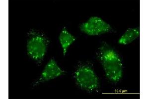 Immunofluorescence of monoclonal antibody to RABGAP1 on HeLa cell. (RABGAP1 Antikörper  (AA 1-110))