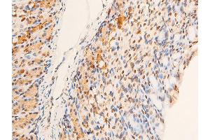 ABIN6267251 at 1/100 staining mouse gastric tissue sections by IHC-P. (CHEK2 Antikörper  (pThr383))
