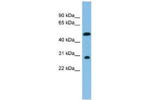 WB Suggested Anti-HOXC8 Antibody Titration: 0. (HOXC8 Antikörper  (Middle Region))