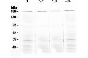 Western blot analysis of Ace using anti-Ace antibody . (Angiotensin I Converting Enzyme 1 Antikörper)