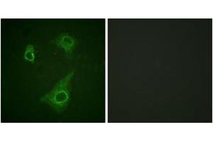 Immunofluorescence analysis of HepG2 cells, using Epo-R (Phospho-Tyr368) Antibody. (EPOR Antikörper  (pTyr368))