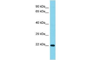 Host: Rabbit Target Name: C1orf158 Sample Type: Jurkat Whole Cell lysates Antibody Dilution: 1. (C1ORF158 Antikörper  (N-Term))