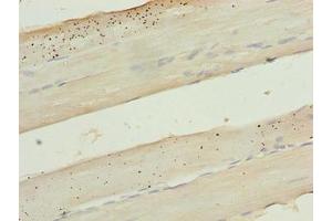 Immunohistochemistry (IHC) image for anti-Keratin 8 (KRT8) (AA 1-300) antibody (ABIN7157468)