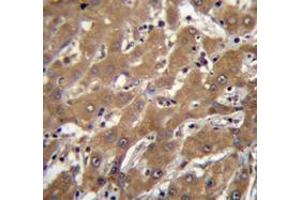 Immunohistochemistry (Paraffin-embedded Sections) (IHC (p)) image for anti-Speckle-Type POZ Protein-Like (SPOPL) (AA 228-357), (Middle Region) antibody (ABIN954939)